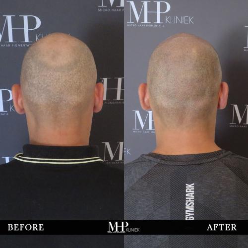 MHP-Before-After-11