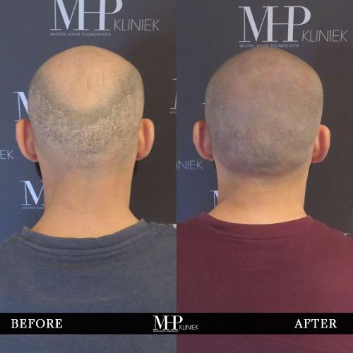 MHP-Before-After-13