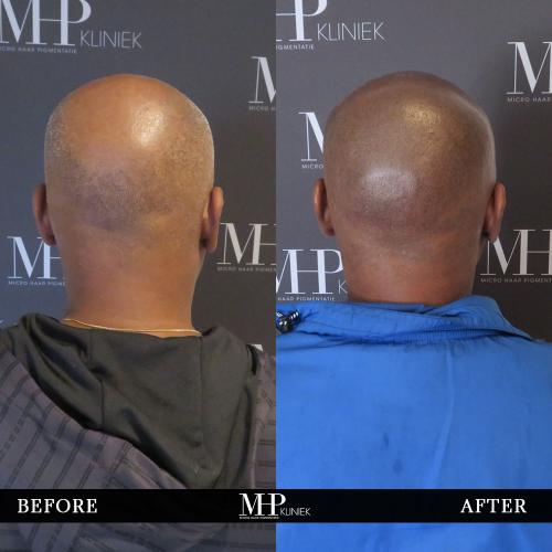 MHP-before-after-28