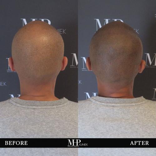 MHP-before-after-3