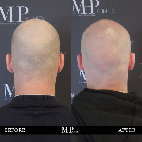 MHP-before-after-8